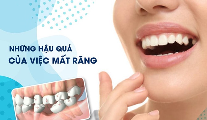 Nha khoa Hưng Thịnh - Gò Vấp